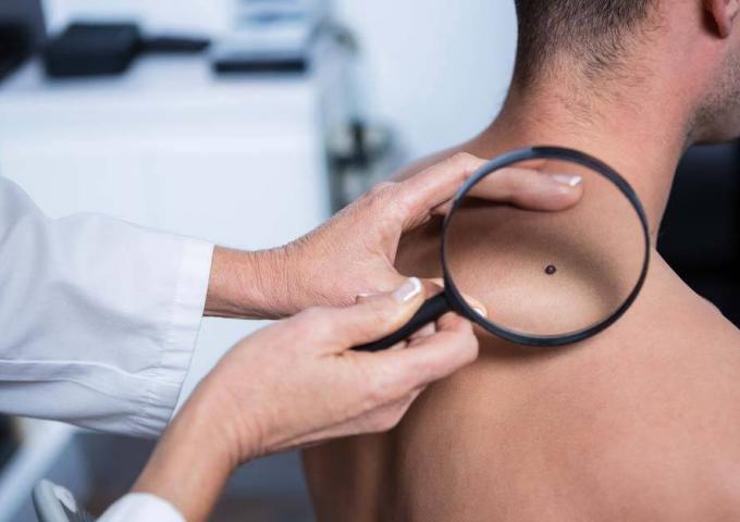 Skin Cancer | Skindoc Dermatologists | Liverpool Sydney | Dr Jennifer Yip