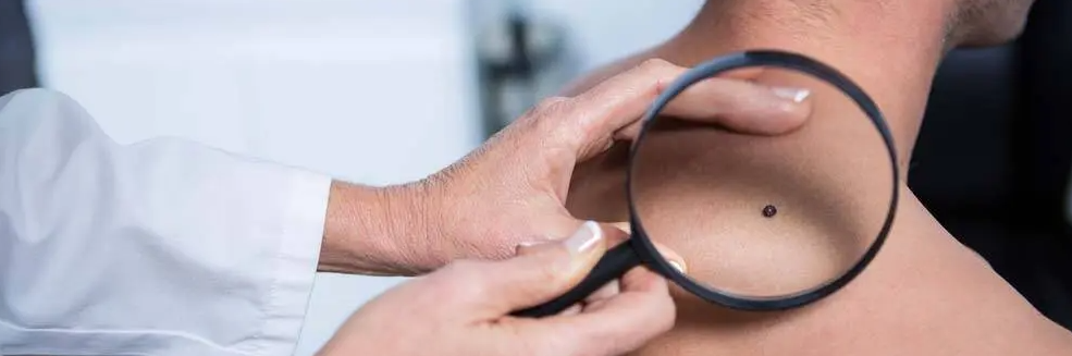 Skin Cancer - Skindoc | Dr Jennifer Yip | Dermatologist | Sydney