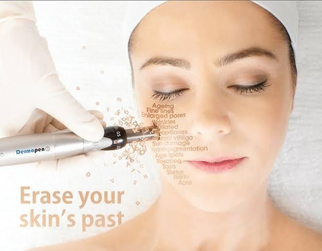 Dermapen - Skindoc | Dr Jennifer Yip | Dermatologist | Sydney